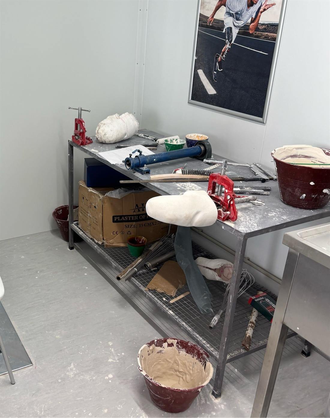 A prosthetics fabrication workshop: plaster casts and a part-finished socket clamped to a steel workbench, surrounded by vices, rasps and buckets of plaster, beneath a poster of a runner wearing a blade prosthesis.